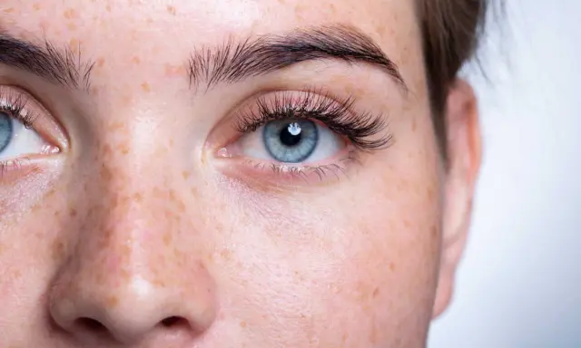 Gros plan sur un visage de femme aux yeux bleus et à la peau tachetée de rousseur. Ses cils courts et peu fournis encadrent un regard intense.