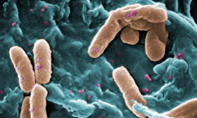 Immagine al microscopio elettronico di Pseudomonas aeruginosa, un batterio contagioso che si presenta come bastoncini marroni su uno sfondo bluastro.