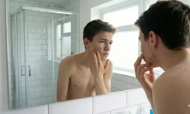 Un adolescent examine son visage dans le miroir, préoccupé par son acné.