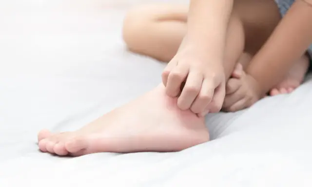 Un enfant se gratte les jambes qui démangent le soir, cherchant un peu de répit avant de dormir.