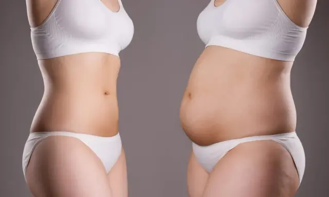 Comparaison de deux silhouettes : l'une mince et tonique, l'autre avec un ventre plus rond, illustrant le parcours pour perdre de la graisse.