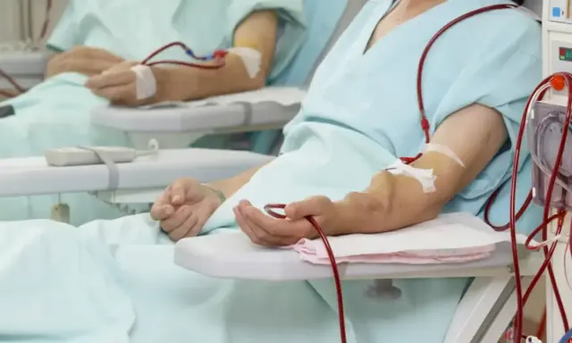Pacjenci podłączeni do aparatury dializacyjnej. Czy dializa boli? To zależy od indywidualnego progu bólu i rodzaju zabiegu.
