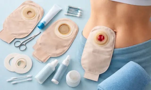 Zestaw do pielęgnacji stomii: worek, przylepce, nożyczki, kremy i spraye. Urostomia co to? To stomia moczowa.