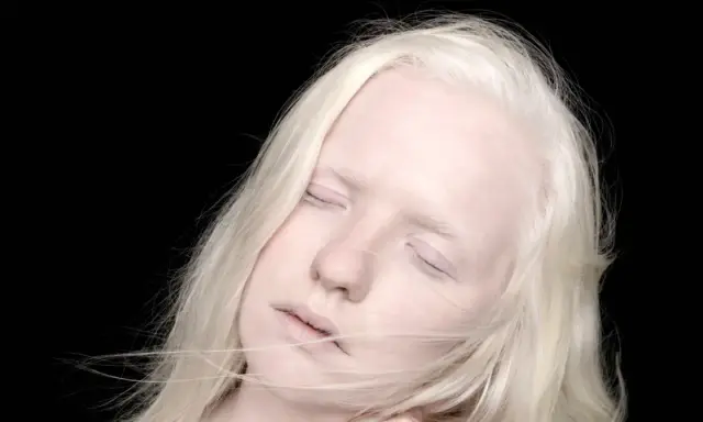 Portret albinosa z blond włosami i zamkniętymi oczami na czarnym tle.