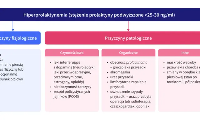 Schemat przyczyn hiperprolaktynemii. Metoklopramid może wpływać na poziom prolaktyny, podobnie jak stres czy ciąża.