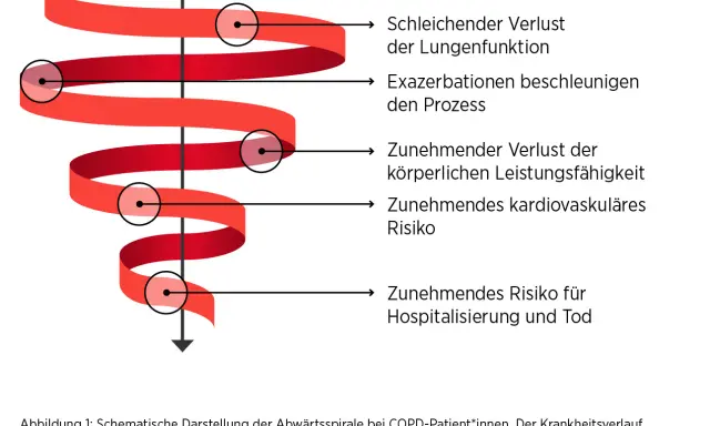 Abwärtsspirale bei COPD: schleichender Lungenfunktionsverlust, Exazerbationen, körperliche Leistungseinbußen, kardiovaskuläres Risiko, Hospitalisierung. Gewichtsverlust ist ein Zeichen des Endstadiums.