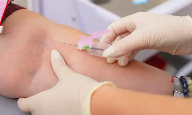 Pobieranie krwi do badania, które może wykazać, czy limfocyty podwyższone u dorosłego wymagają dalszej diagnostyki.
