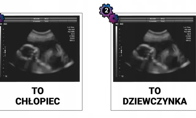 Jak rozpoznać płeć dziecka na USG? Kiedy i na co patrzy lekarz?