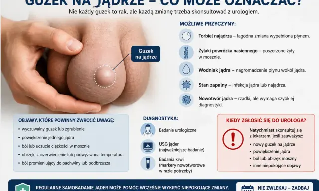 Powiększone i twarde jądro z wyczuwalnym guzem. Obraz przedstawia powiększone jądro z widocznym guzem, podkreślając potrzebę konsultacji urologicznej.
