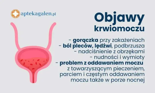 Objawy krwiomoczu: gorączka, ból pleców, nadciśnienie, nudności, wymioty, problem z oddawaniem moczu. Uszkodzenie cewki moczowej objawy mogą być podobne.