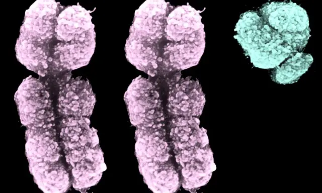 Cromosomi colorati, due rosa e uno turchese, che illustrano la sindrome XXY.