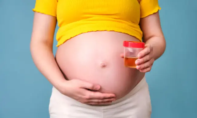 Ciężarna kobieta trzyma pojemnik z próbką moczu, badanie na obecność ketonów w moczu w ciąży.