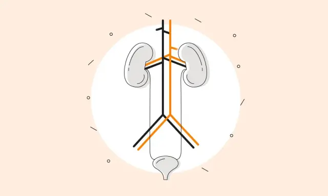 Ilustracja układu moczowego z naczyniami, symbolizująca powikłania dializy otrzewnowej.