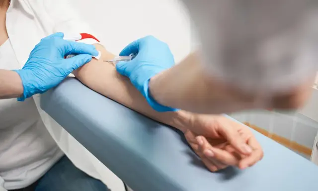 Pobieranie krwi do badań, które pomogą ocenić, co produkuje progesteron.
