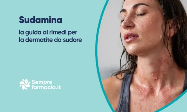 Sudamina adulti: la guida ai rimedi per la dermatite da sudore. Pelle arrossata e irritata dal caldo.