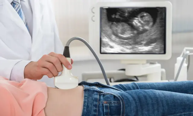 Lekarz wykonuje USG. Na ekranie widać zarodek, to 11 tydzień ciąży, który to miesiąc rozwoju dziecka.
