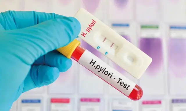 Rękawiczka trzyma probówkę z krwią i test kasetkowy. Dwa paski na teście wskazują, że test ureazowy dodatni.