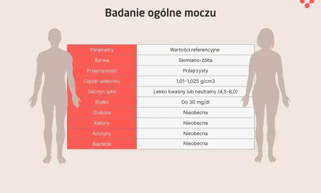 Tabela z badaniem ogólnym moczu: parametry, wartości referencyjne. Uryna co to? To płyn wydalany przez nerki, a jego analiza ujawnia wiele o zdrowiu.