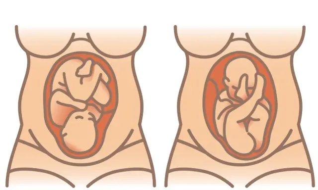 Zwei Darstellungen eines schwangeren Bauches. Links liegt das Baby mit dem Kopf nach unten, rechts mit dem Kopf nach oben. Wie oft dreht sich das Baby im Bauch am Tag?