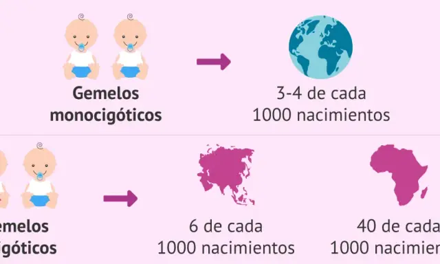 La imagen muestra que tener gemelos dicigóticos es hereditario, con tasas de nacimientos variables por continente.