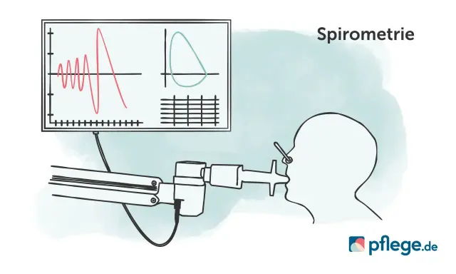 Spirometrie-Diagramm zeigt Lungenfunktion. Wichtig für COPD Gold 3 Rente.