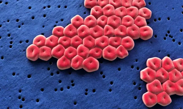 Acinetobacter baumannii, batterio resistente, si guarisce. Globuli rossi rossi su sfondo blu con piccoli fori.