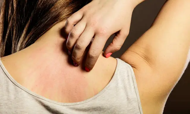 En person kliar sig på axeln och nacken, där huden är röd och irriterad. Kanske är det klåda vid stress som visar sig.
