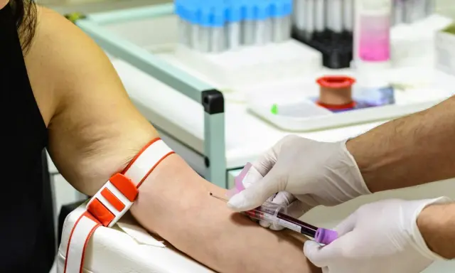 Wysokie żelazo w surowicy? Zrozum wyniki i chroń zdrowie