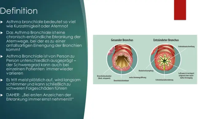 Vergleich gesunder und entzündeter Bronchien. Bei Asthma kommt es zu Muskelverkrampfungen und Schwellungen, die die Atemwege verengen.