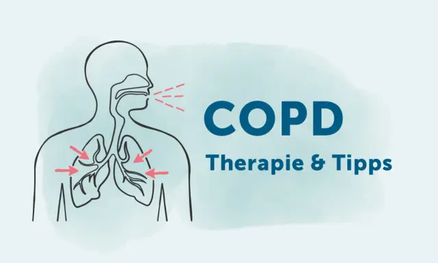 Illustration zeigt Lunge und Atemwege. Rote Pfeile deuten auf die Lunge. Text: COPD Therapie & Tipps. Wichtige Infos zu COPD Medikamente.
