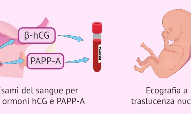 Esami del sangue per ormoni hCG e PAPP-A, ecografia a traslucenza nucale: il tri test per la salute del feto.