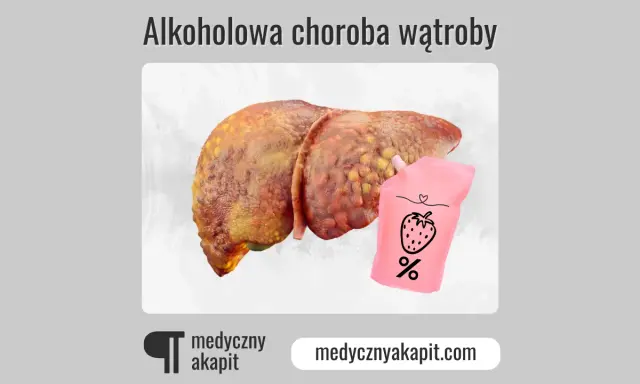 Chora wątroba i woreczek z napisem "%" sugerują, czy alkoholowe zapalenie wątroby jest wyleczalne.