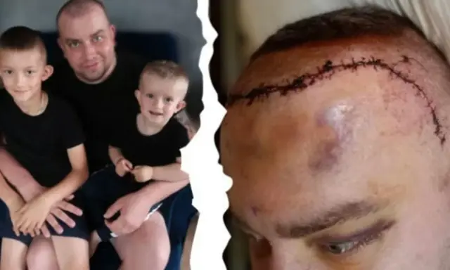 Ojciec z synami, a obok jego głowa po operacji. Historia o tym, jak się umiera na glejaka, jest trudna.