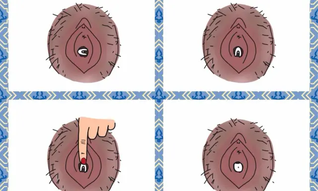 Illustration visar hur en menskopp vecklar ut sig. En hand trycker på den för att hjälpa den att veckla ut sig.