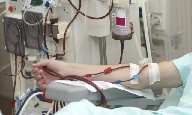 Ramię pacjenta podłączone do aparatury do dializy. Częstotliwość dializ jest kluczowa dla jego zdrowia.
