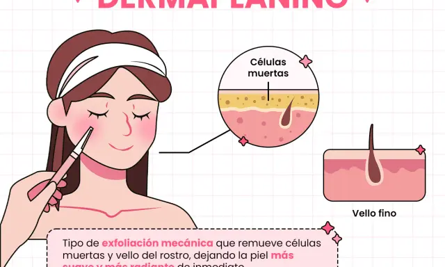 Ilustración de un **dermaplaning facial** que elimina células muertas y vello fino para una piel suave y radiante.