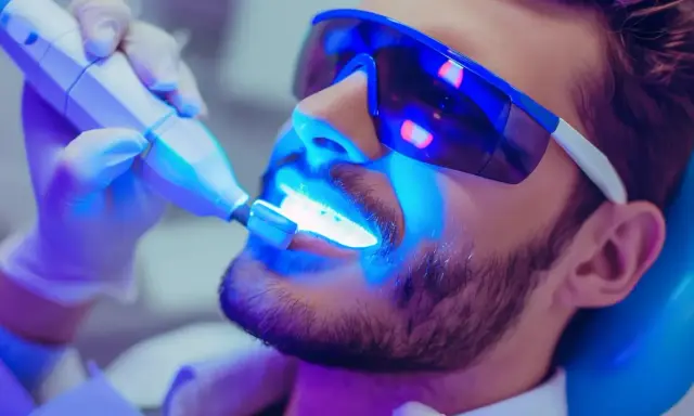 Wybielanie zębów u dentysty: czy warto? Analiza kosztów i efektów