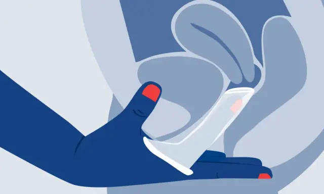 Ilustración de mano insertando un condón femenino. Explora los diversos tipos de condones femeninos para una protección segura.