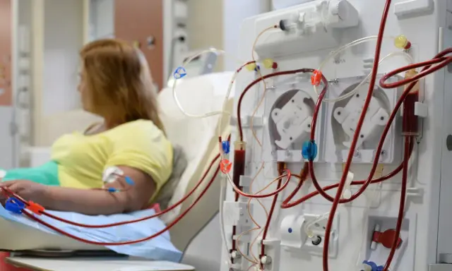 Kobieta podłączona do dializatora, który jest kluczowym elementem w leczeniu niewydolności nerek.