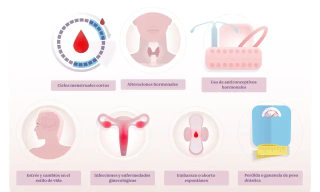 Ilustración muestra posibles causas de la regla cada 15 días: ciclos cortos, alteraciones hormonales, anticonceptivos, estrés, infecciones, embarazo o cambios de peso.