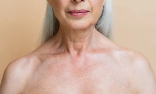 Gros plan sur le décolleté d'une femme âgée, montrant les marques du temps et les dégâts du soleil sur la peau.