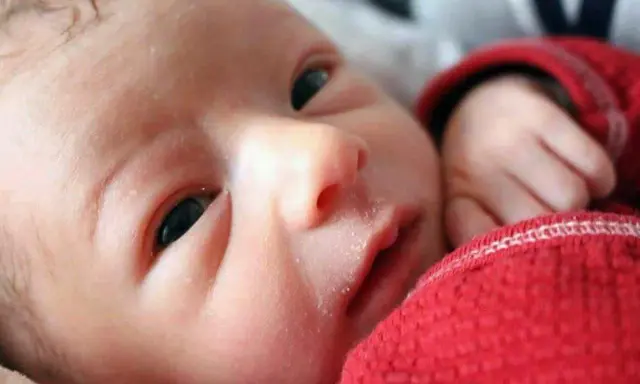 Primo piano di un neonato con lieve crosta lattea sulle sopracciglia, avvolto in una coperta rossa.