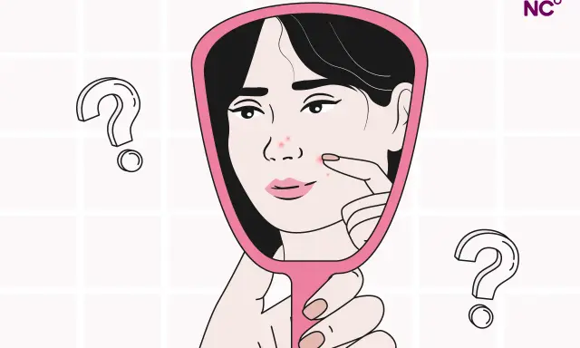 Una mujer se mira en un espejo, examinando granos en su rostro. ¿Será esto un sangrado por deprivación?