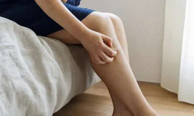Donna seduta sul letto si gratta la gamba, soffrendo di prurito alle anche.