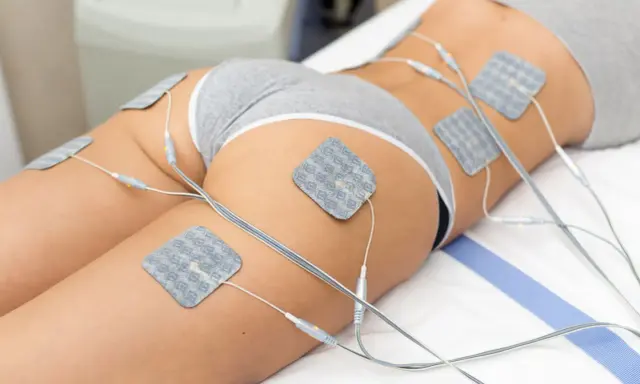 Elektrostymulacja efekty po 10 zabiegach: widoczne napięcie mięśni ud i pośladków dzięki elektrostymulacji.