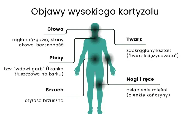 Objawy wysokiego kortyzolu: mgła mózgowa, garb, otyłość brzuszna, księżycowata twarz, osłabienie mięśni.