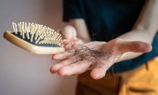 Main d'une personne tenant une brosse à cheveux avec des cheveux tombés, un effet secondaire possible du covid et perte de cheveux.