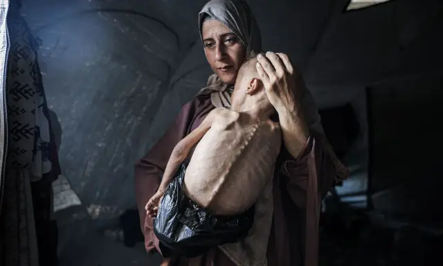 Een moeder troost haar ondervoede kind in een tent. Dit is wat er gebeurt in Gaza: honger en wanhoop.