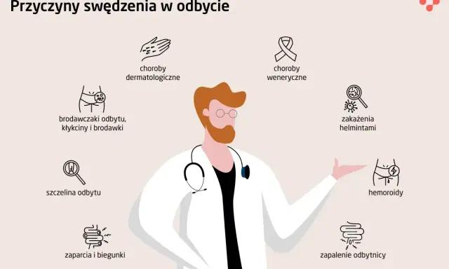 Lekarz omawia przyczyny swędzenia odbytu, w tym hemoroidy, zaparcia i biegunki, które mogą wymagać leczenia domowego.