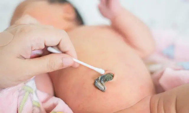 Jak czyścić kikut pępowinowy? Prosty poradnik dla rodziców